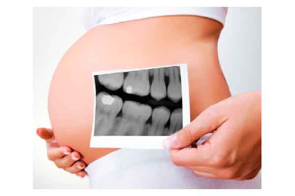 embarazo dentista clinica dental molina de segura