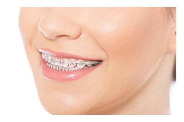 ortodoncia dentista clinica dental molina de segura
